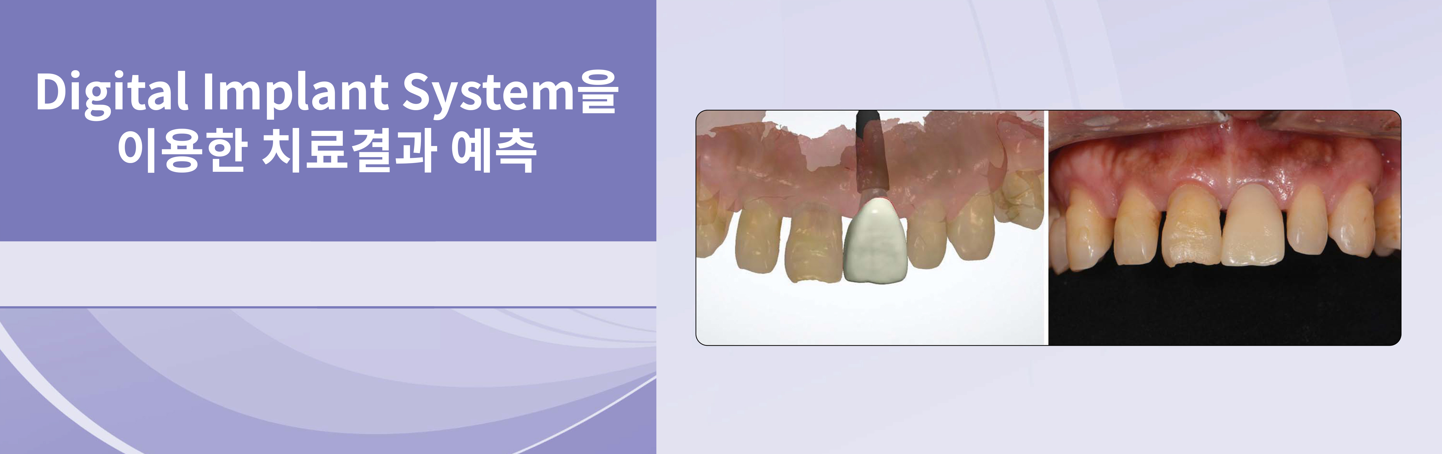 디지털월드치과
