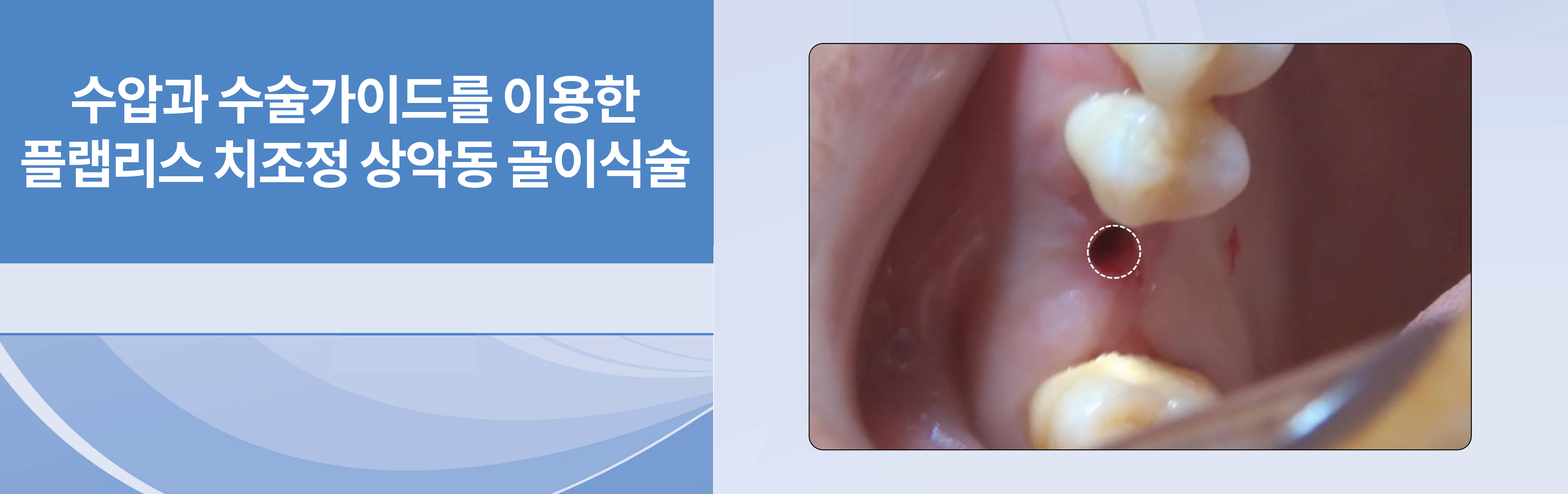 디지털월드치과